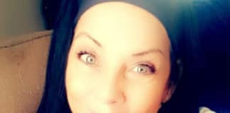 Mayo denies kidney transplant for unvaccinated patient Mayo