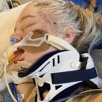 Colleen Kelly’s daughter Anya Magnuson five days after being hit in October 2021. (Colleen Kelly/Twitter)