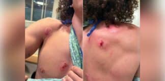 No charges in Minneapolis attack that left teen worker assaulted and bitten