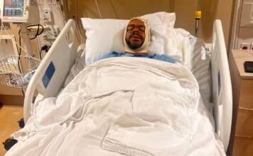 Sammy Kimbrough recovers in a hospital bed after suffering multiple jaw fractures in an assault at the Minnesota State Fair