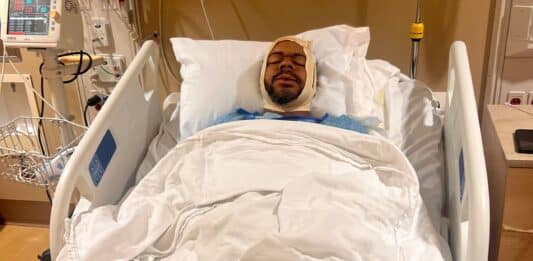Sammy Kimbrough recovers in a hospital bed after suffering multiple jaw fractures in an assault at the Minnesota State Fair