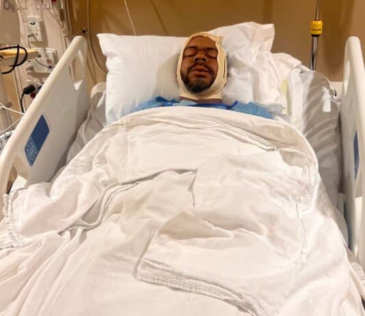 Sammy Kimbrough recovers in a hospital bed after suffering multiple jaw fractures in an assault at the Minnesota State Fair